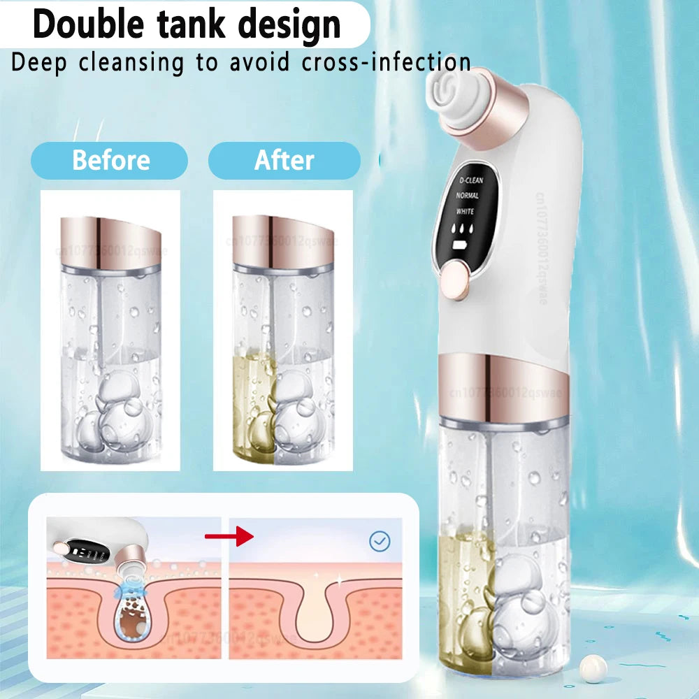 Rechargeable Blackhead Remover Pore Vacuum – Deep Clean & Clear Skin