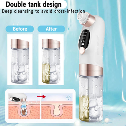 Rechargeable Blackhead Remover Pore Vacuum – Deep Clean & Clear Skin