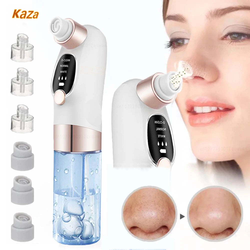 Rechargeable Blackhead Remover Pore Vacuum – Deep Clean & Clear Skin