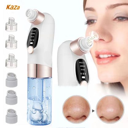 Rechargeable Blackhead Remover Pore Vacuum – Deep Clean & Clear Skin