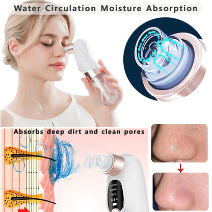 Rechargeable Blackhead Remover Pore Vacuum – Deep Clean & Clear Skin